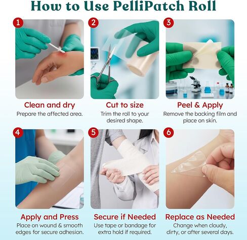 Pimple Patches - Cut-to-Size - Pimple Patch Roll (16 Feet x 2 Inch) Hydrocolloid Roll Bandages Medical Tape Wound Care & Acne Zits - Clear Large Self-Adhesive Ultra Absorbent Waterproof Bulk First Aid in Saudi Arabia