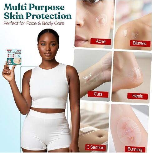 Pimple Patches - Cut-to-Size - Pimple Patch Roll (16 Feet x 2 Inch) Hydrocolloid Roll Bandages Medical Tape Wound Care & Acne Zits - Clear Large Self-Adhesive Ultra Absorbent Waterproof Bulk First Aid in Saudi Arabia