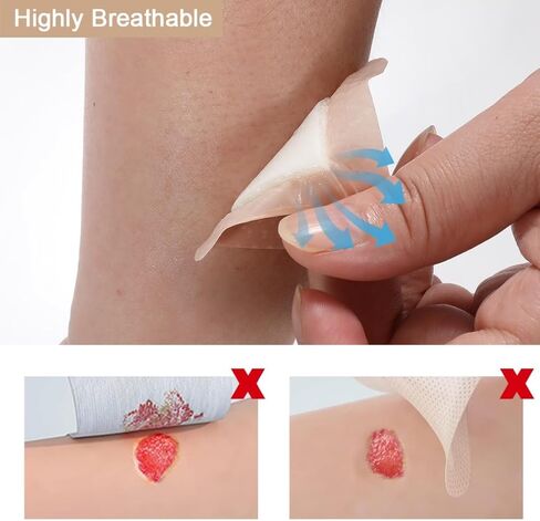 ضمادة إسفنجية من السيليكون مع حدود لاصقة 2 × 2 بوصة مقاومة للماء لتضميد الجروح، ضمادة ماصة من إسفنج السيليكون للعناية بالجروح، حدود لطيفة، 10 قطع in Kuwait