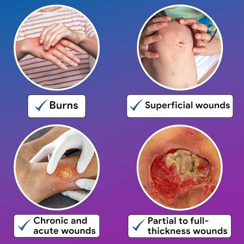 ضمادات إسفنجية مقاومة للماء مقاس 8 × 8 بوصة - 10 ضمادات إسفنجية معقمة للجروح - وسادات شديدة الامتصاص وغير لاصقة وغير ذات حدود - جيدة للجروح المتوسطة والثقيلة in Kuwait