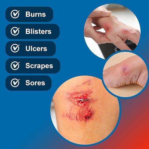 ضمادات الجروح بالكولاجين مقاس 10.16 سم × 10.16 سم - 30 وسادة كولاجين للحروق والخدوش والبثور والمزيد - من أجل الحد الأدنى من الإفرازات الثقيلة والجروح الجزئية إلى الجروح ذات السُمك الكامل in Kuwait