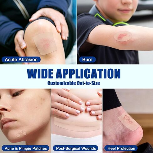 لفة غرواني مائي مقاس 2 بوصة × 5 أقدام، ضمادات للعناية بالجروح مقاومة للماء، ضمادات نفطة للأقدام، بقع حب الشباب، رقع غرواني مائي مرنة وخالية من اللاتكس in Kuwait