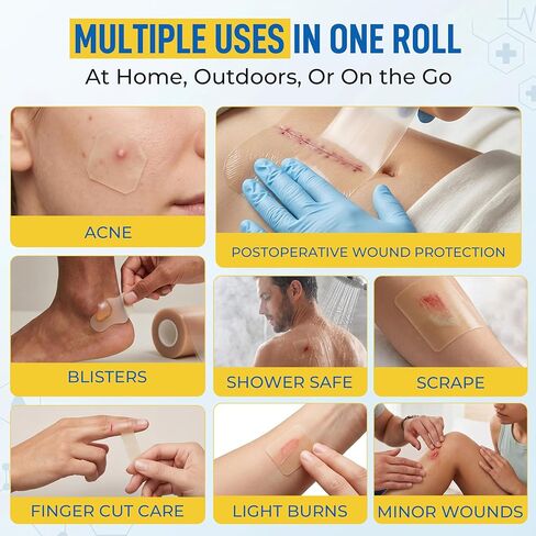 لفة غرواني مائي من الدرجة الطبية للعناية بالجروح | ضمادة مقطوعة حسب الحجم للحروق والبثور | بقع بثرة لحب الشباب | ضمادة ذاتية اللصق مقاومة للماء فائقة الامتصاص (2 بوصة × 5 قدم) in Kuwait