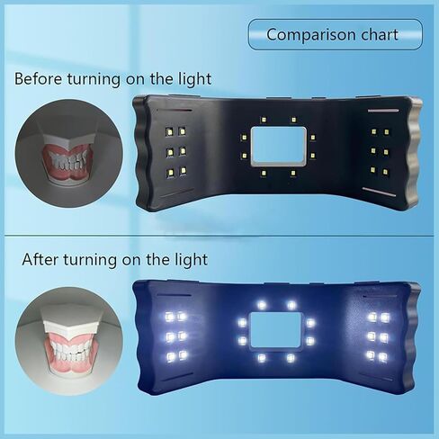 طقم إضاءة LED للتصوير الفوتوغرافي للأسنان مع مخرج 32000 لوكس - 20 خرزة إضاءة محيطية ثلاثية الأبعاد للقطات داخل الفم وإجراءات التجميل والتصوير الكلي in Kuwait