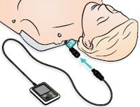 SkillGuide - جهاز تقديم الملاحظات QCPR لدمى Laerdal CPR in Kuwait