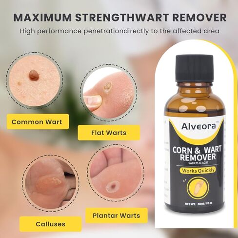 Wart Remover Liquid Wart Remover Freeze Off Fast Acting Salicylic Acid Wart Removers for Genital,H,Common,Flat, Corn and Callus, Warts, Plantar NDC Code:85248-034 in Saudi Arabia