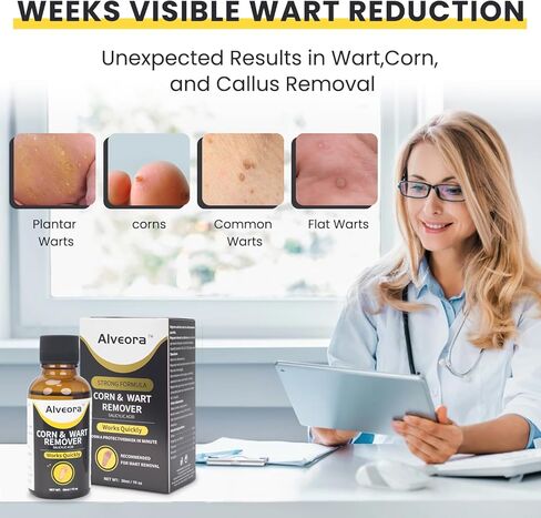 Wart Remover Liquid Wart Remover Freeze Off Fast Acting Salicylic Acid Wart Removers for Genital,H,Common,Flat, Corn and Callus, Warts, Plantar NDC Code:85248-034 in Saudi Arabia