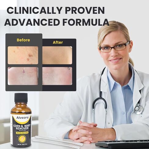Wart Remover Liquid Wart Remover Freeze Off Fast Acting Salicylic Acid Wart Removers for Genital,H,Common,Flat, Corn and Callus, Warts, Plantar NDC Code:85248-034 in Saudi Arabia