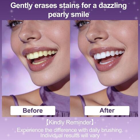7-Pro Whitening Toothpaste with 7 Probiotics, Advanced Stain Removal Formula for Gum Health, Purple Burst Beads for Fresh Breath, Fluoride-Free & Enamel Safe (2 PCS) in Saudi Arabia
