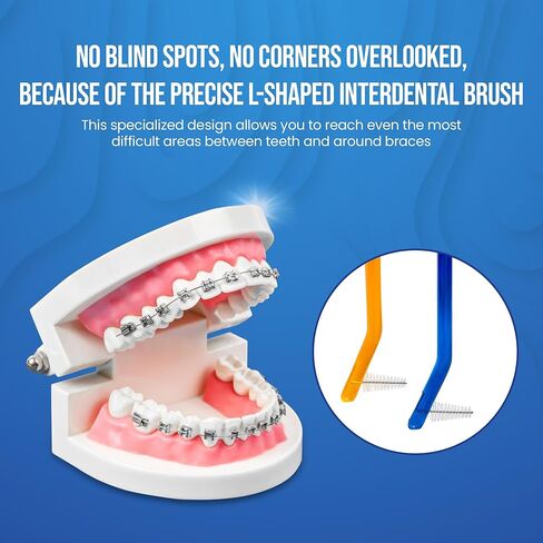 Toothbrush for Braces, Soft Head Braces Toothbrush, V Trimmed Design 2-Pack | Quick Orthodontic Cleaning | Deep Clean Braces at Home (Pack of 2) in Saudi Arabia