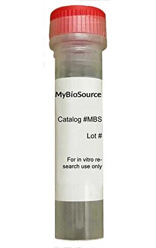 Recombinant Human Cone-rod homeobox protein (CRX) (Recombinant Protein) in Saudi Arabia