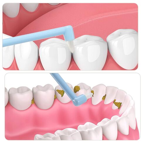 Patelai 6 Pieces End Tuft Toothbrush Single Tufted Toothbrush Soft Interdental Brushes Tooth Stain Remover for Implants Teeth Detail Cleaning Tooth Stain (Bright Colors) in Saudi Arabia