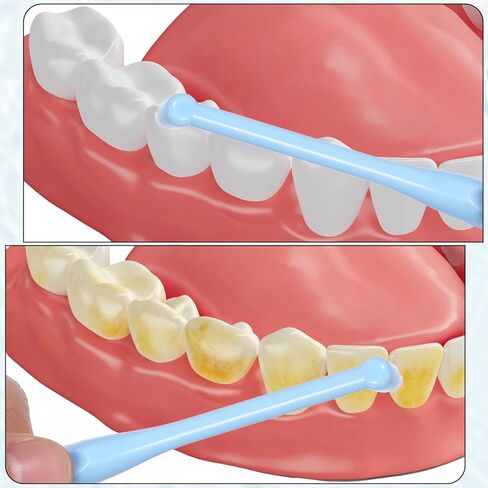 4 PCS End Tuft Toothbrush Adult, Gum Single End Tuft Brush, Soft Orthodontic Toothbrushes for Braces, Small Soft Head for Tiny Hard-to-Reach Areas Detail Cleaning, Individually Wrapped in Saudi Arabia