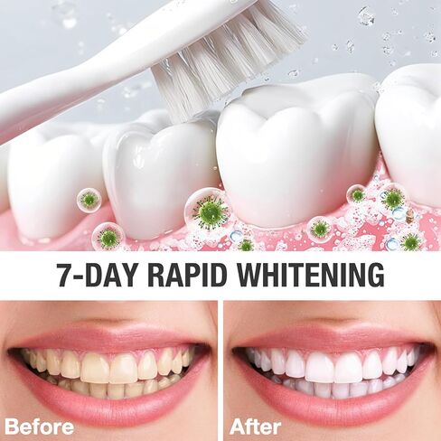 2PCS Nano Hydroxyapatite Toothpaste for Advanced Enamel Protection and Tooth Strengthening, Gentle and Effective Formula, Gentle Mint, Fresh Breath, Reduce Tooth Sensitivity in Saudi Arabia
