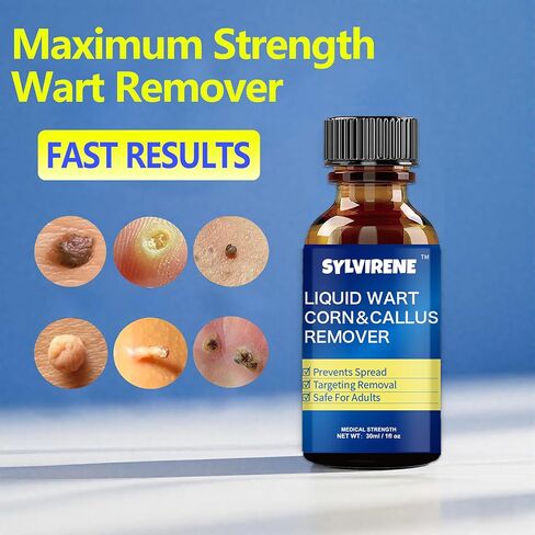 Wart Remover Liquid,17% Salicylic Acid,Quick Removal,Rapid-Acting,wart Remover Freeze Off for Common Warts,Corns and calluses(NDC Code：84010-079-01) in Saudi Arabia
