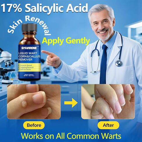 Wart Remover Liquid,17% Salicylic Acid,Quick Removal,Rapid-Acting,wart Remover Freeze Off for Common Warts,Corns and calluses(NDC Code：84010-079-01) in Saudi Arabia