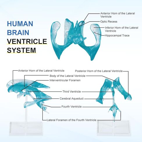 qzzXoq Human Brain Ventricle Model, Enlarged Brain Ventricle Anatomy Model with Central Nerves Ventricle for Medical Experimental Teaching and Educational Display Tools in Saudi Arabia