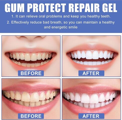 Gum Protect Dental Repair Gel,Oral Care Therapy Formula,Professional Gums Health Solution,Gum Instant Treatment Gel(2 Packs) in Saudi Arabia