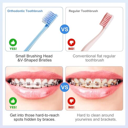 6 Pack Orthodontic Toothbrushes with Covers, Soft Bristles V-Shaped Dental Brushes for Braces, Archwires, and Daily Oral Care in Saudi Arabia
