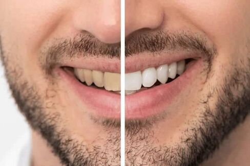 Marvs Smokers Toothpaste – Whitening Toothpaste for Tobacco & Coffee Stain Removal | Enamel Safe, Fresh Breath, Intense Mint | Travel Size 85ml (3oz) | Made in Italy in Saudi Arabia