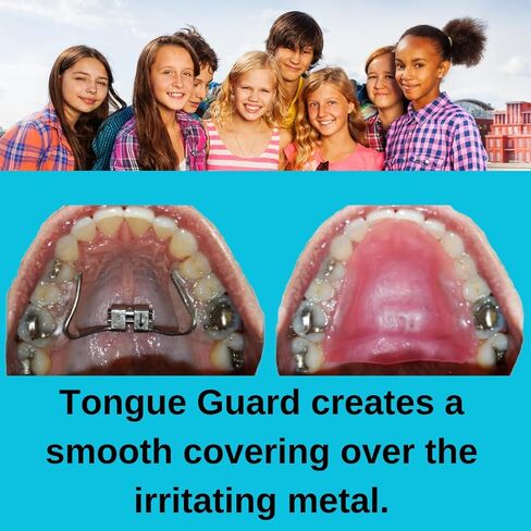 RPE Tongue Guard: Prevents and Helps Heal Tongue Sores Caused by Dental Expanders | Tongue Sores | Metal Cuts | Dental Ortho Braces | in Saudi Arabia