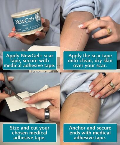 بكرة شريط الندبات السيليكون من NewGel Plus - صفائح ندبات سيليكون طبية بنسبة 100% للجراحة والقسم القيصري وندبات الجدرة وحب الشباب - شريط سيليكون سميك للغاية 1 مم قابل لإعادة الاستخدام - صنع في الولايات المتحدة الأمريكية - 1.5 بوصة × 48 بوصة in Kuwait