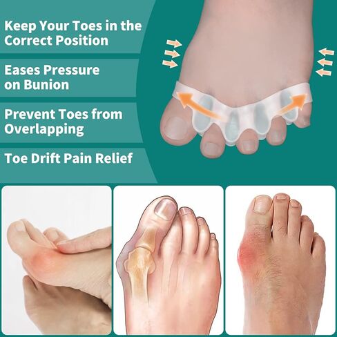 Pack of 10 Toe Separator, Silicone Toe Spacers for Correct Toe Alignment, Toe Spreader for Bunions Correct, Restore Overlapping Toes to Original Shape(Size: XL) in Saudi Arabia