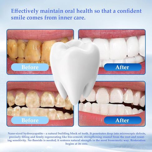 Nano Hydroxyapatite Powder for DIY Toothpaste, Teeth Whitening Repair Tooth Enamel Strong Teeth High Material hydroxyapatite are Very Suitable for DIY40 Grams in Saudi Arabia