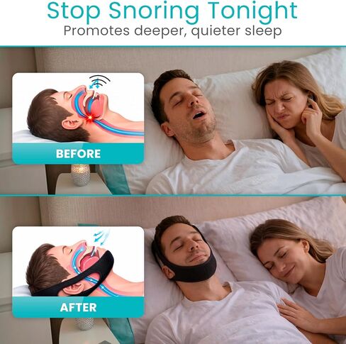 Vive Anti Snore Chin Strap for Sleeping - Stop Snoring Solution for CPAP Users - Airflow Head Band Device for Sleep Apnea Relief - Breathe Right, Mouth Breathing Prevention Accesories (Black) in Saudi Arabia