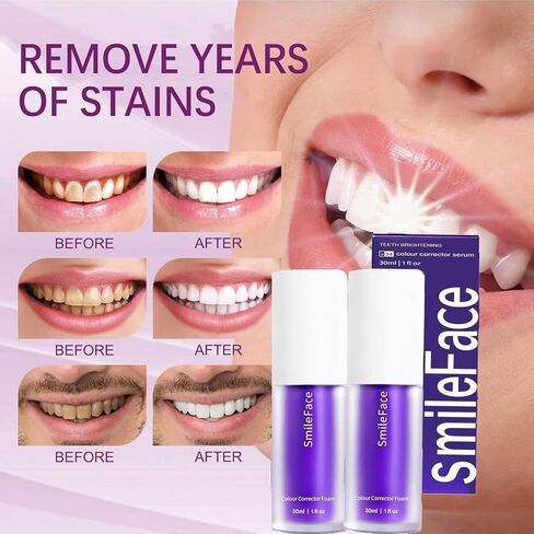 Purple Toothpaste for Teeth Whitening,Purples Teeth Whitening Kit,2PCS Purple Color Corrector Whitening Toothpaste,Tooth Stain Removal,Fresh Breath Formula with Unique Purple for Coffee/Smokers/Tea in Saudi Arabia