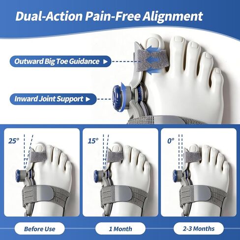 Bunion Corrector for Women & Men, Orthopedic Hallux Valgus Corrector with Adjustable Knob & Silicone Pad, Bunion Pain Relief, Fits Both Left & Right Feet, One Size Fits Most (1PACK) in Saudi Arabia