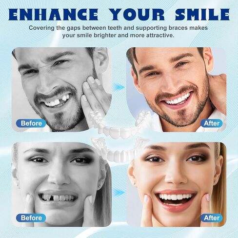 قشور سناب اون للنساء والرجال - أطقم أسنان صناعية مؤقتة، مظهر طبيعي وملاءمة مريحة، غطاء أسنان علوي وسفلي قابل للتشكيل بنفسك in Kuwait