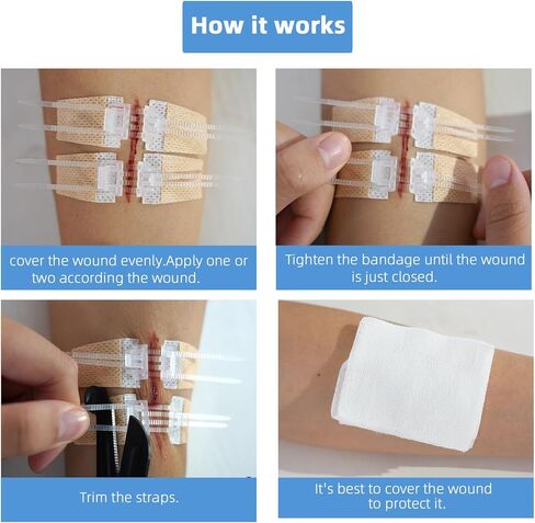 Emergency Wound Closure Strips, Butterfly Band-Aids in Kuwait