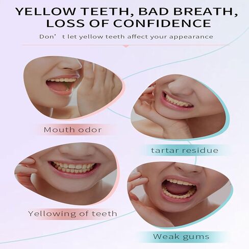Toothpaste Niacinamide, Whitening Toothpaste Niacinamide, Niacinamide Intensive toothpastes, Fresh Breath Toothpastes, Remove Tooth Stains in Kuwait