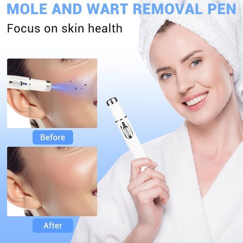 Dual-TROL Skin Tag Removal Kit, Best Remover Product for Skin Tags and Warts, Portable and Rechargeable Tools to Use at Home-M in Saudi Arabia