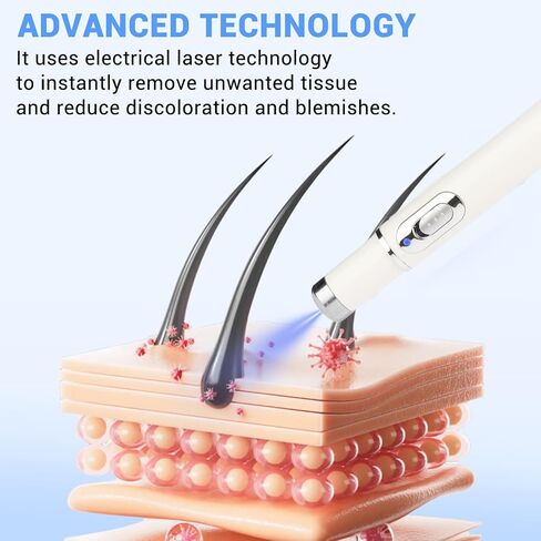 Dual-TROL Skin Tag Removal Kit, Best Remover Product for Skin Tags and Warts, Portable and Rechargeable Tools to Use at Home-M in Saudi Arabia