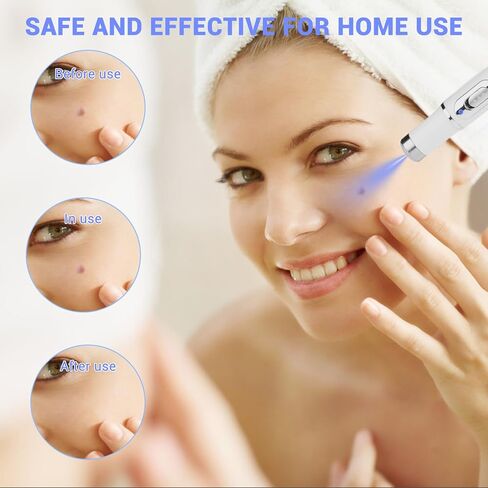 Dual-TROL Skin Tag Removal Kit, Best Remover Product for Skin Tags and Warts, Portable and Rechargeable Tools to Use at Home-M in Saudi Arabia