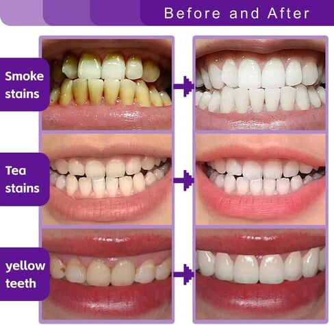 Fluoride Free Toothpaste, Appropriate for Sensitive Teeth, for Adult, Kids Oral Care - Whitening* Refresh Mint, 3.5 oz in Kuwait