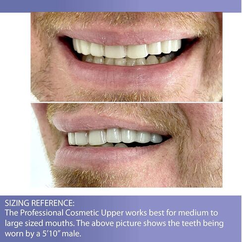 Professional Cosmetic Upper - New from Instant Smile! Hand Crafted Detail, Custom fit at Home! Works Best in Medium to Large Sized Mouths. in Kuwait