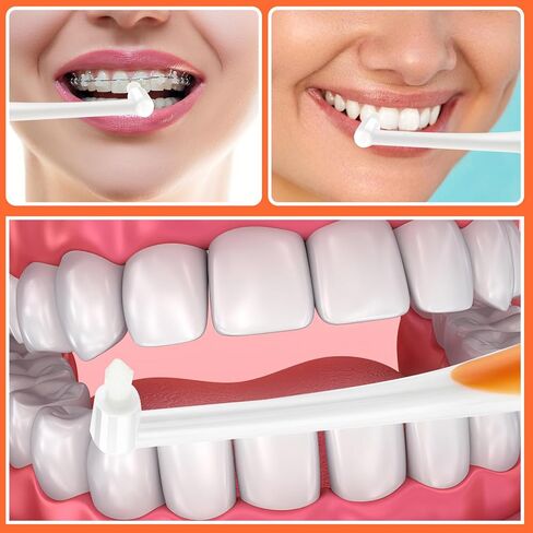 فرشاة أسنان ذات 5 قطع من Ouligay، فرشاة أسنان معنقدة، فرشاة أسنان ذات خصلة واحدة، فرشاة أسنان للكبار، فرشاة أسنان صغيرة صغيرة لتقويم الأسنان بين الأسنان لتنظيف الأقواس بالتفصيل in Kuwait