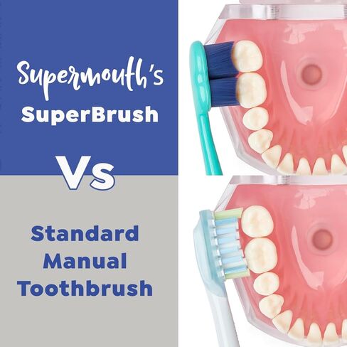 SuperMouth® SuperBrush® Manual Toothbrush – Ultra-Soft Patented SuperBristles® Conform to Teeth for 30X Better Cleaning, Deep Plaque Removal, Sensitive Teeth & Gum Care, Preteens to Adults in Saudi Arabia