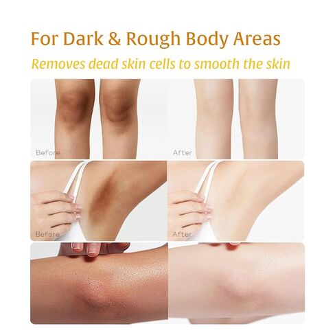 4 in 1 Turmeric & Kojic Acid Brightening Set for Intimate Area: Dark Spot Remover, Dead Skin Cells Remover, Skin Brightening, Even Tone, for Body, Underarm, Knees, Elbows, Inner Thigh, Bikini Areas in Kuwait