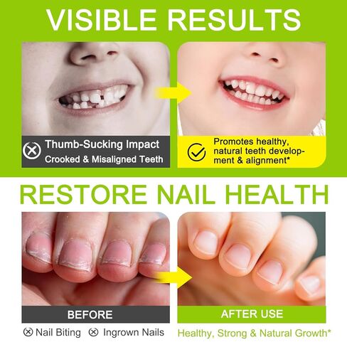 Nail Biting Treatment for Kids, (2pcs) Thumb Sucking Deterrent, Nail Biting Prevention for Kids, Safe and Natural Plant Bitter Formula, Nail Care Stop Biting Nails-0.24floz in Kuwait