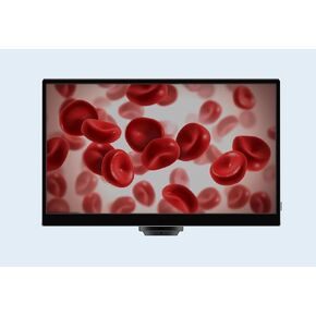 كاميرا مجهر CX3 بدقة 5.0 ميجابكسل HDMI مع شاشة TFT مقاس 11.6 بوصة in Kuwait