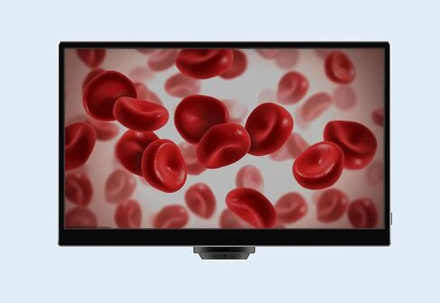 CX3 5.0MP HDMI Microscope Camera with 11.6-Inch TFT Display in Kuwait