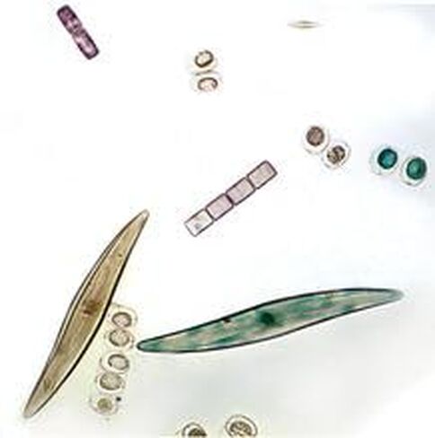 Freshwater and Marine Diatoms Slide, W.M. in Kuwait