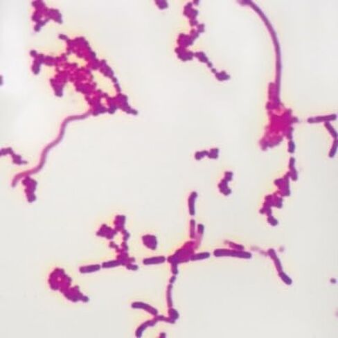 Mixed Smear of Bacteria Types Slide, W.M., Carbol-Fuchsin in Kuwait