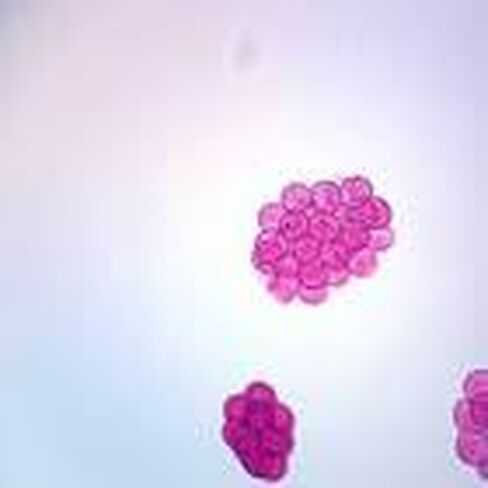 Dipylidium Caninum Eggs Slide, W.M. in Kuwait