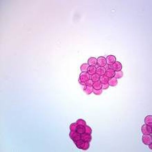 Dipylidium Caninum Eggs Slide, W.M. in Kuwait