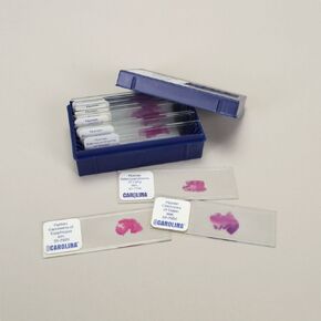 Malignant Tissues Microscope Slide Set in Kuwait